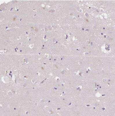Immunohistochemistry: KLHL24 Antibody [NBP2-37705]