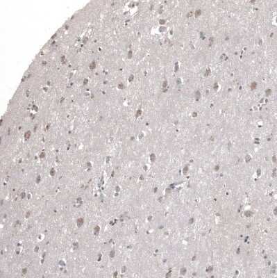 Immunohistochemistry-Paraffin: KLHL24 Antibody [NBP2-37705]