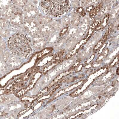 Immunohistochemistry-Paraffin: KLHL24 Antibody [NBP2-37705]