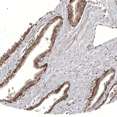 Immunohistochemistry-Paraffin: KLHL24 Antibody [NBP2-37705]