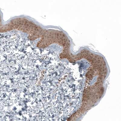 Immunohistochemistry-Paraffin: KLHL24 Antibody [NBP2-37705]
