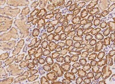 Immunohistochemistry-Paraffin: KLHL24 Antibody [NBP3-05979]