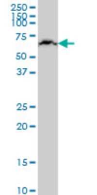 Western Blot: KLHL25 Antibody (1E9) [H00064410-M09]