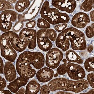 Immunohistochemistry-Paraffin: KLHL25 Antibody [NBP1-83974]