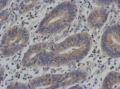 Immunohistochemistry-Paraffin: KLHL25 Antibody [NBP2-17082]