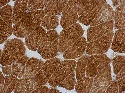 Immunohistochemistry-Paraffin: KLHL25 Antibody [NBP2-17082]