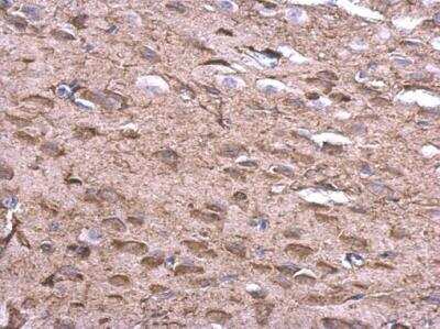 Immunohistochemistry-Paraffin: KLHL25 Antibody [NBP2-17082]