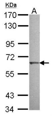 Western Blot: KLHL25 Antibody [NBP2-17082]