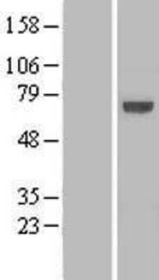 Western Blot: KLHL25 Overexpression Lysate [NBL1-12338]