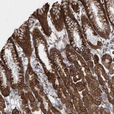 Immunohistochemistry-Paraffin: KLHL26 Antibody [NBP2-34187]