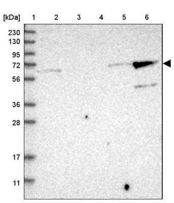 Western Blot: KLHL26 Antibody [NBP2-34187]