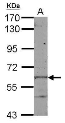 Western Blot: KLHL28 Antibody [NBP2-17083]