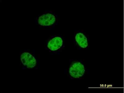 Immunocytochemistry/ Immunofluorescence: KLHL29 Antibody [H00114818-B01P]