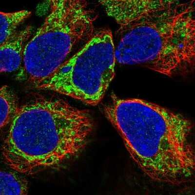 Immunocytochemistry/ Immunofluorescence: KLHL29 Antibody [NBP2-56832]