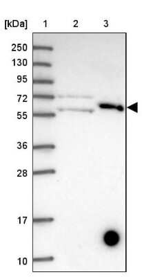 Western Blot: KLHL29 Antibody [NBP2-14167]