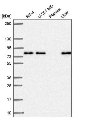 Western Blot: KLHL29 Antibody [NBP2-56832]