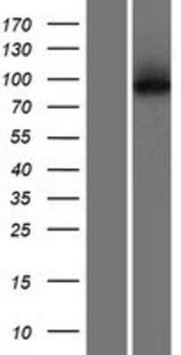 Western Blot: KLHL29 Overexpression Lysate [NBP2-10161]