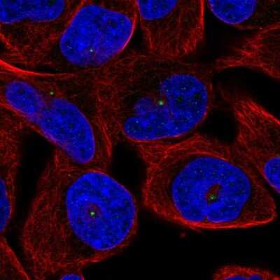 Immunocytochemistry/ Immunofluorescence: KLHL30 Antibody [NBP2-57215]