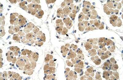 Immunohistochemistry-Paraffin: KLHL31 Antibody [NBP1-70594]
