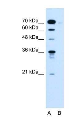 Western Blot: KLHL31 Antibody [NBP1-70594]