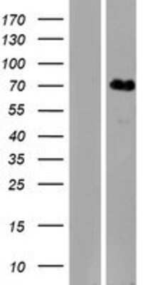 Western Blot: KLHL31 Overexpression Lysate [NBP2-08920]