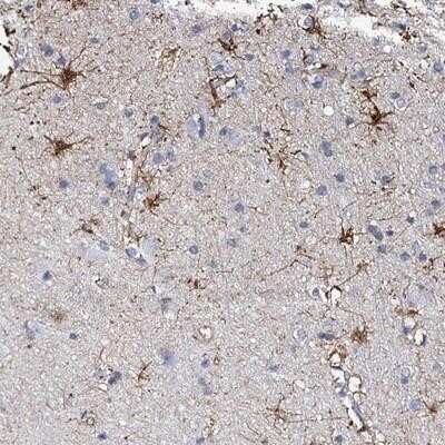 Immunohistochemistry-Paraffin: KLHL32 Antibody [NBP2-14169]