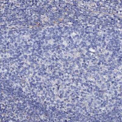 Immunohistochemistry-Paraffin: KLHL32 Antibody [NBP2-14169]
