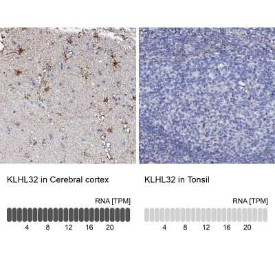 Immunohistochemistry-Paraffin: KLHL32 Antibody [NBP2-14169]