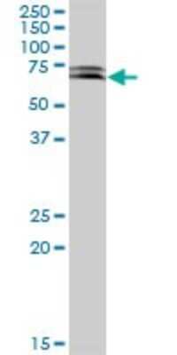 Western Blot: KLHL32 Antibody [H00114792-B01P]