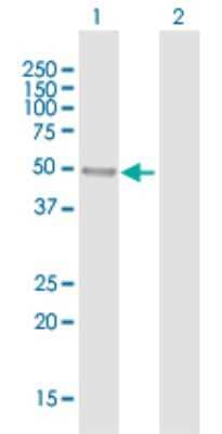 Western Blot: KLHL32 Antibody [H00114792-B01P]