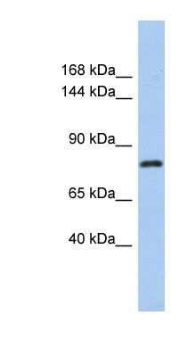 Western Blot: KLHL32 Antibody [NBP1-56298]