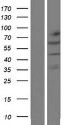 Western Blot: KLHL32 Overexpression Lysate [NBP2-05844]