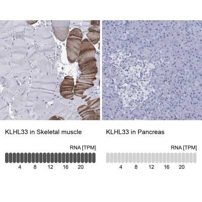 Immunocytochemistry/ Immunofluorescence: KLHL33 Antibody [NBP3-17104]