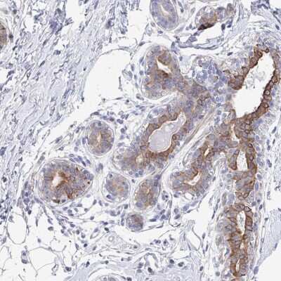 Immunohistochemistry-Paraffin: KLHL33 Antibody [NBP2-34165]