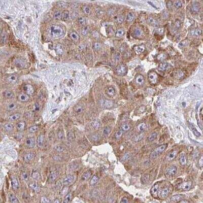 Immunohistochemistry: KLHL34 Antibody [NBP2-32524]