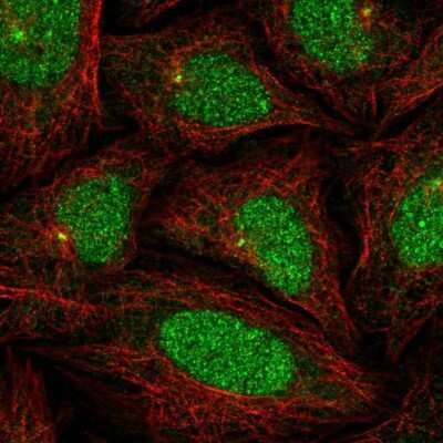 Immunocytochemistry/ Immunofluorescence: KLHL35 Antibody [NBP1-89837]