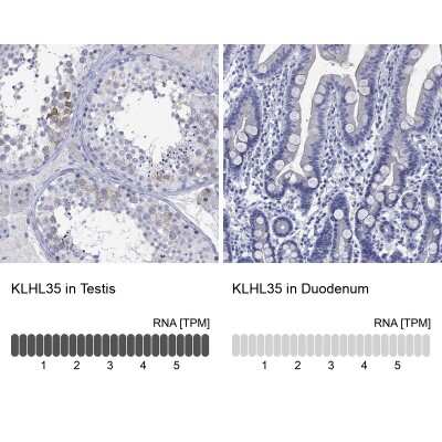 Immunocytochemistry/ Immunofluorescence: KLHL35 Antibody [NBP3-17105]