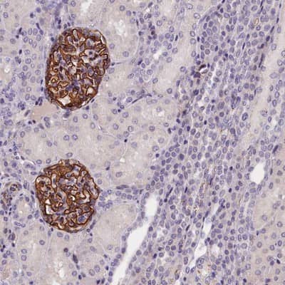 Immunohistochemistry-Paraffin: KLHL35 Antibody [NBP1-89837]