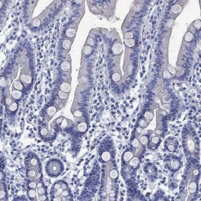 Immunohistochemistry-Paraffin: KLHL35 Antibody [NBP3-17105]
