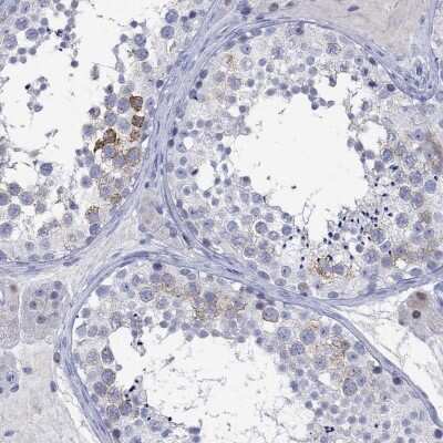 Immunohistochemistry-Paraffin: KLHL35 Antibody [NBP3-17105]