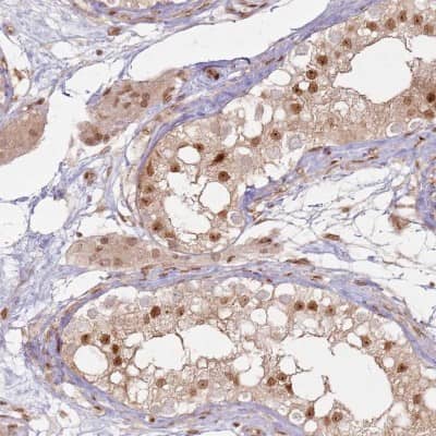 Immunohistochemistry-Paraffin: KLHL36 Antibody [NBP1-92059]
