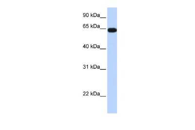 Western Blot: KLHL36 Antibody [NBP2-85162]