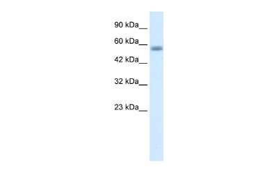 Western Blot: KLHL36 Antibody [NBP2-85163]