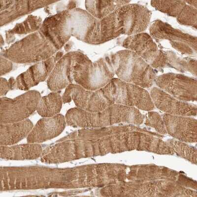 Immunohistochemistry-Paraffin: KLHL38 Antibody [NBP1-91233]