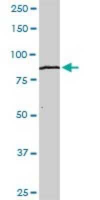 Western Blot: KLHL4 Antibody [H00056062-D01P]