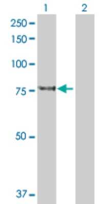 Western Blot: KLHL4 Antibody [H00056062-D01P]