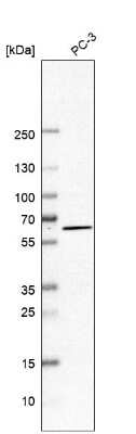 Western Blot: KLHL5 Antibody [NBP1-91102]