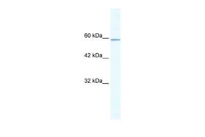 Western Blot: KLHL5 Antibody [NBP2-83121]