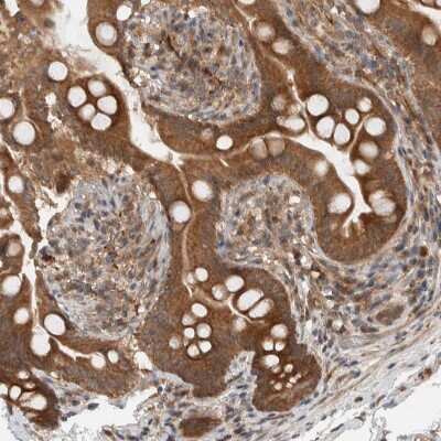 Immunohistochemistry-Paraffin: KLHL6 Antibody [NBP1-83880]