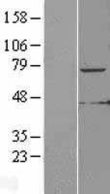 Western Blot: KLHL6 Overexpression Lysate [NBL1-12341]